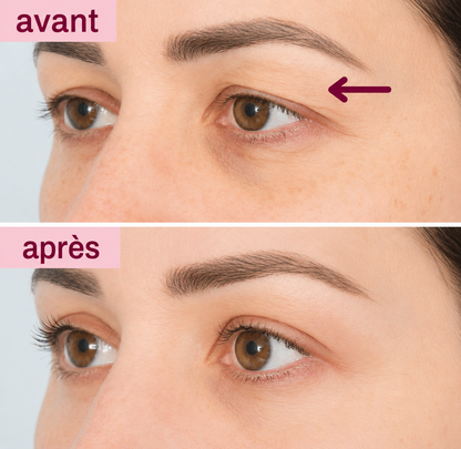 PATCHS EFFET LIFTING