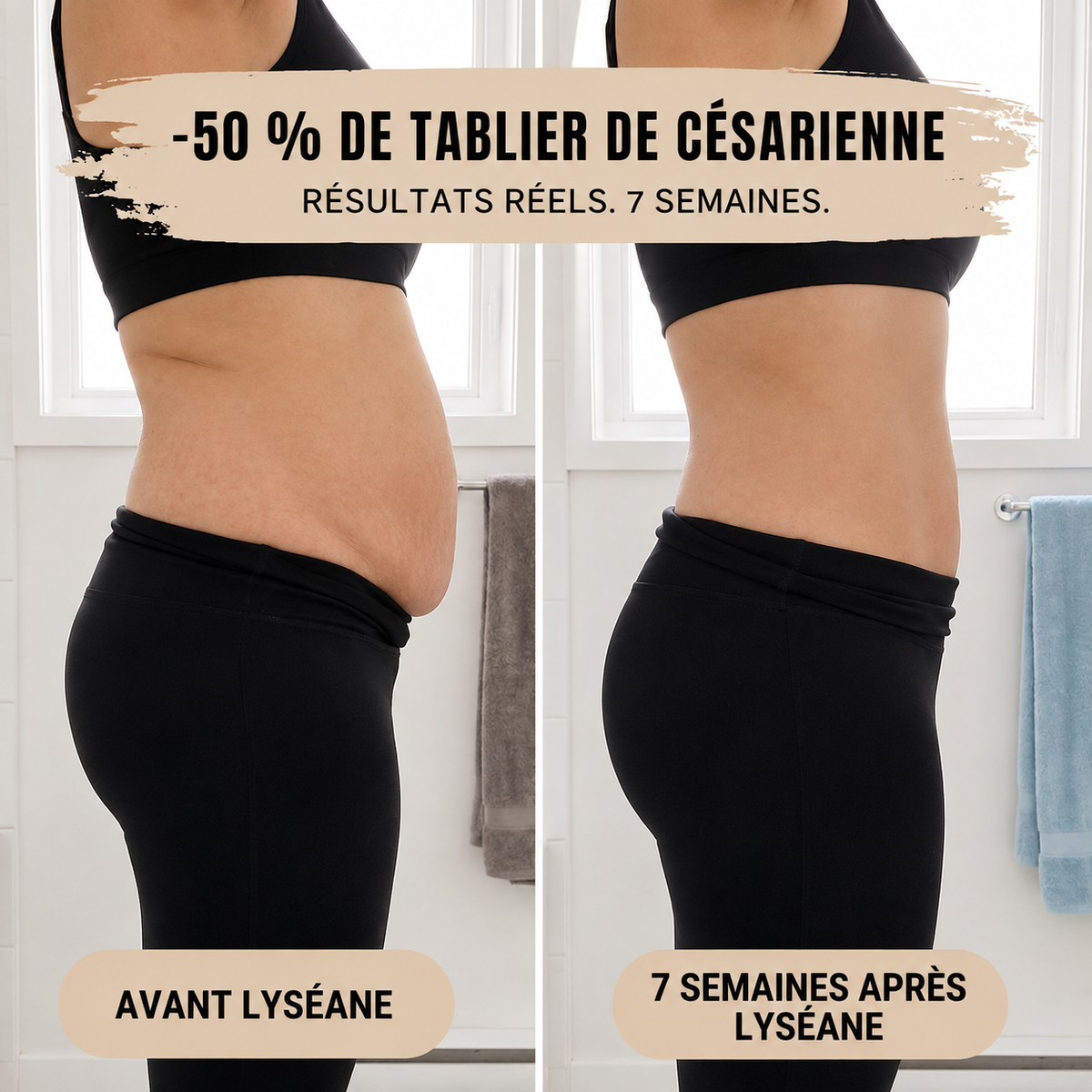 Culotte post-partum compression 360°