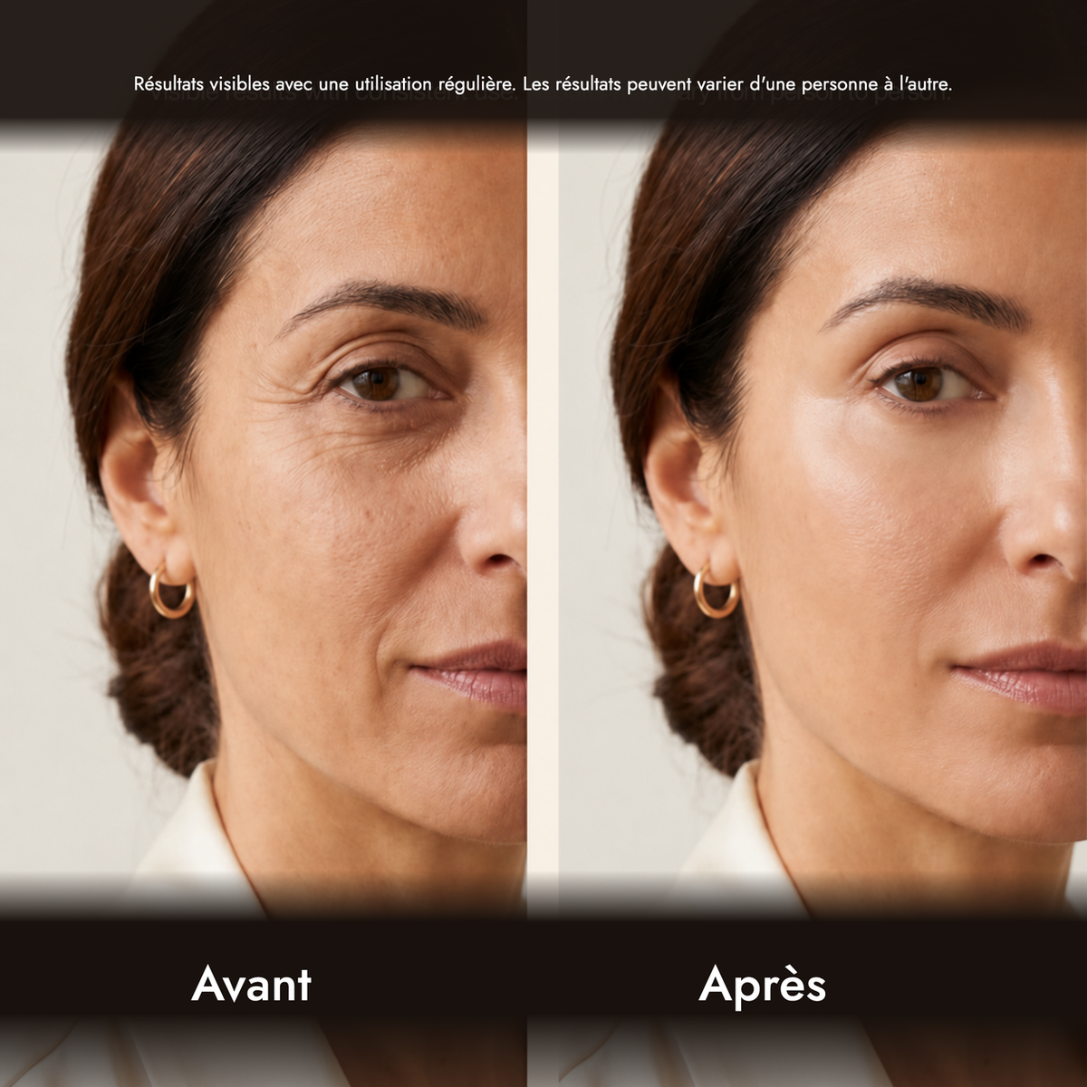 Stick anti-âge Lyséane — visuel 3