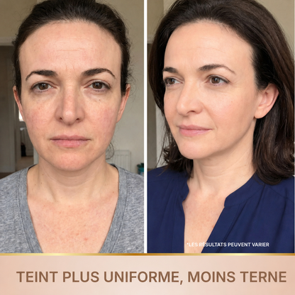Lyséane – Sérum Coréen Effet Liftant dès la Première Application